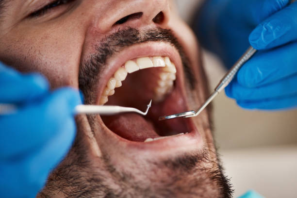 Best Emergency Broken Tooth Repair in Robbins, IL